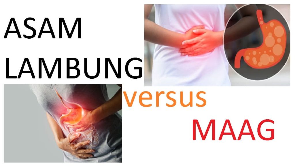 Apa Perbedaan Asam Lambung Dan Maag